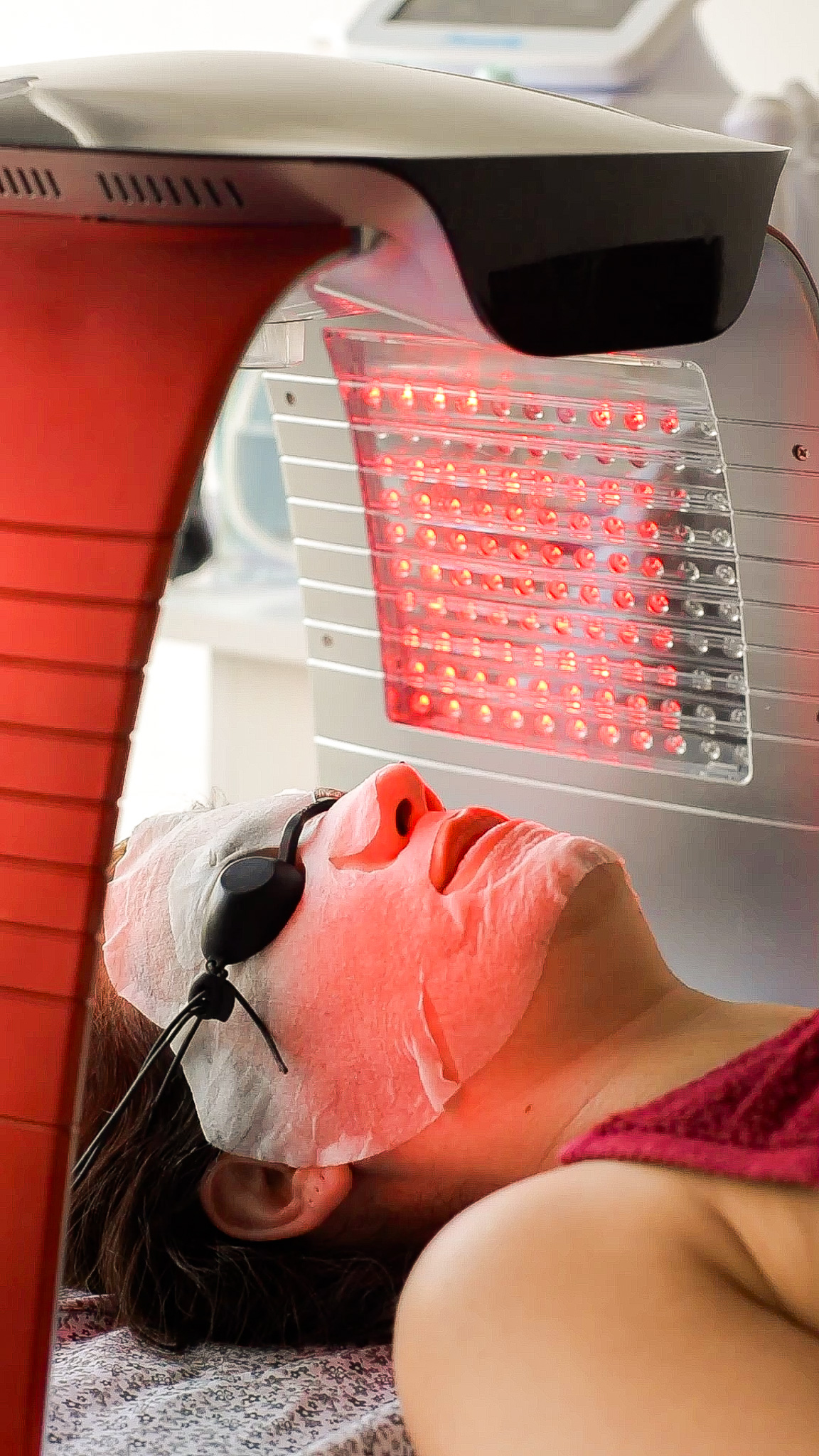 Limpieza Facial Profundo